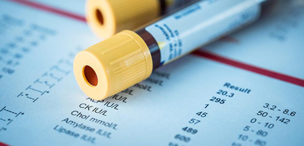 Explorando los costos psicosociales del cáncer de sangre infantil