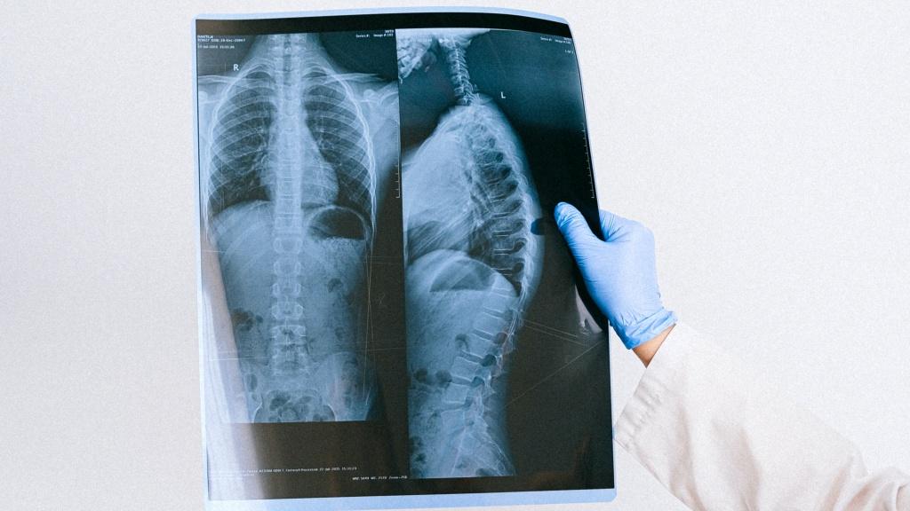 Biases associated with database structure for COVID-19 detection in X-ray images